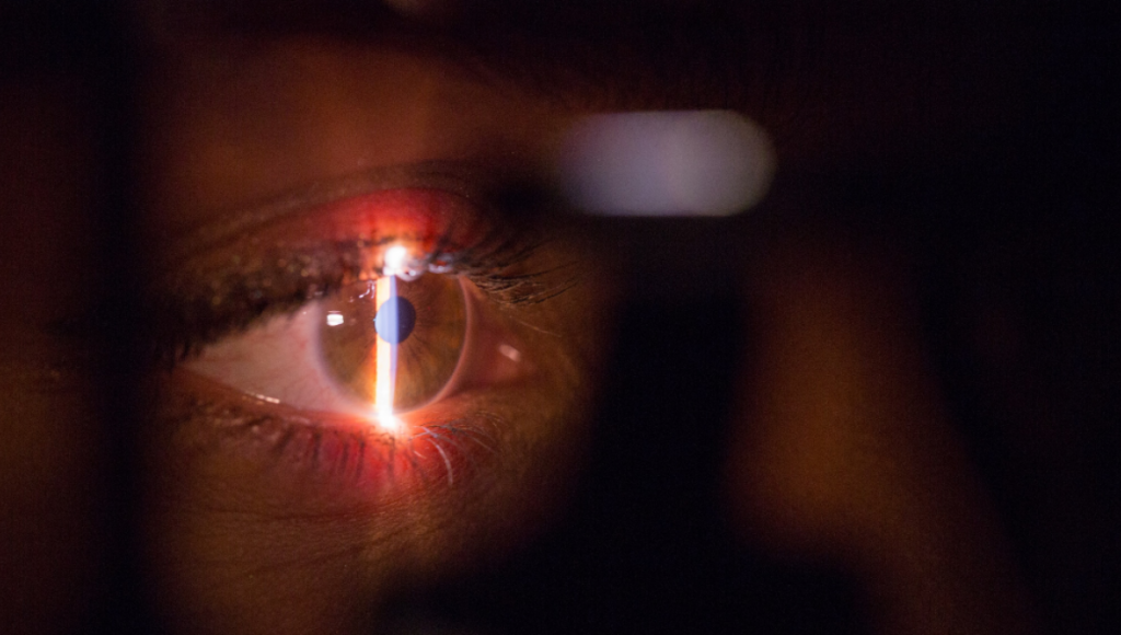 A detail in your eye can tell us whether or not you're in your right mind