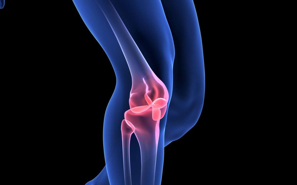 L'arthrite septique se localise très fréquemment (40 %) sur l'articulation du genou. © m3ron, Fotolia