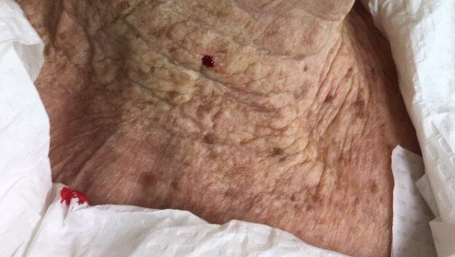 Skin aging: These viral photos show the dangers of unprotected sun exposure